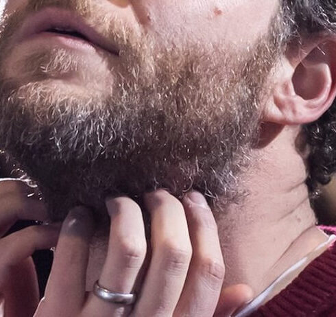 Come eliminare la forfora dalla barba