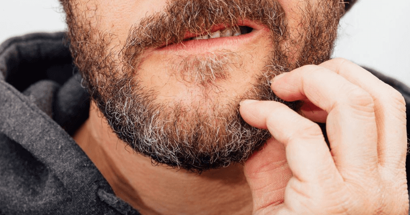 I rimedi per la forfora della barba