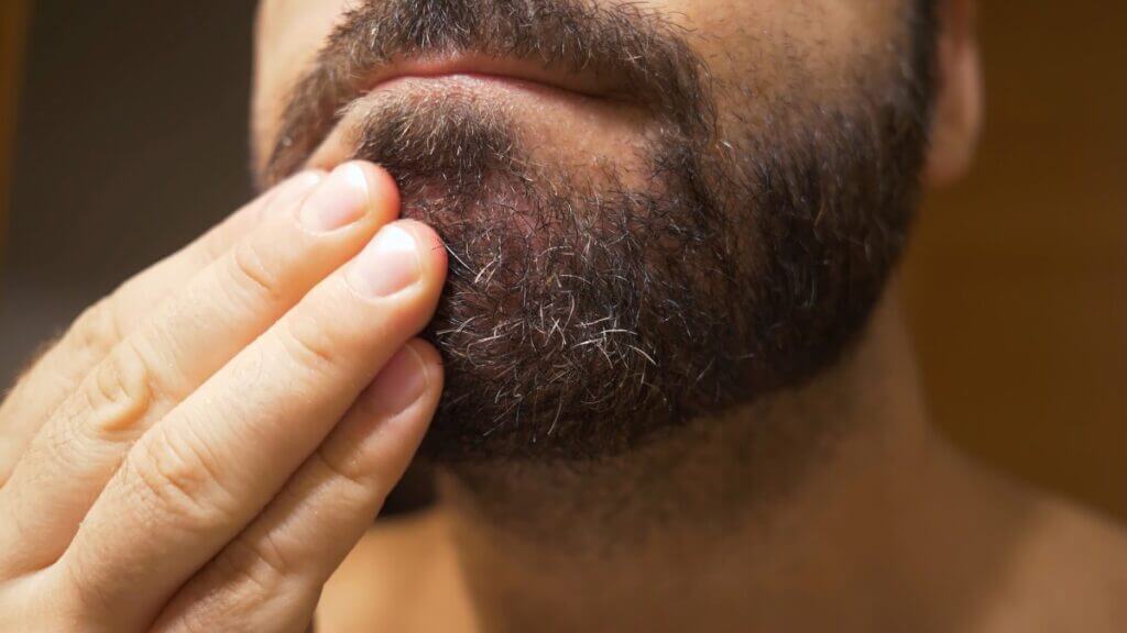 Le cause della forfora nella barba