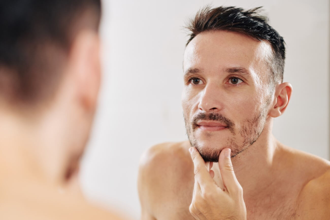 Cosa causa la barba a chiazze